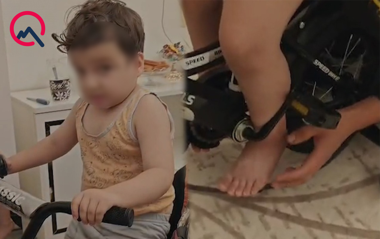 Sumqayıtda azyaşlının ayağı velosipeddə sıxılıb qaldı